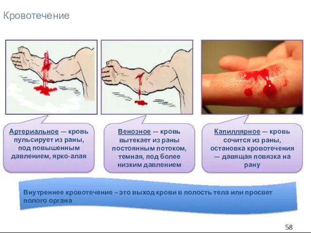 Кровотечение Внутреннее кровотечение – это выход крови в полость тела или просвет