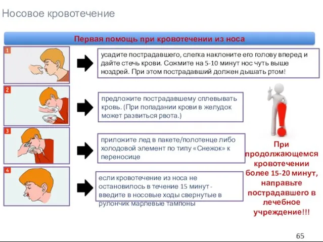 Носовое кровотечение Первая помощь при кровотечении из носа предложите пострадавшему сплевывать кровь.