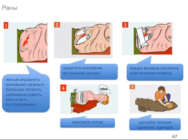 Раны нельзя вправлять выпавшие органы в брюшную полость, запрещено давать пить и