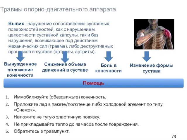 Травмы опорно-двигательного аппарата Вывих - нарушение сопоставление суставных поверхностей костей, как с