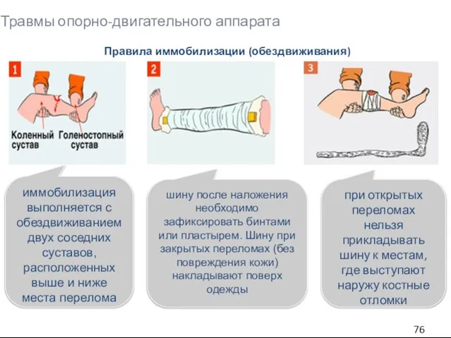 Травмы опорно-двигательного аппарата Правила иммобилизации (обездвиживания) иммобилизация выполняется с обездвиживанием двух соседних