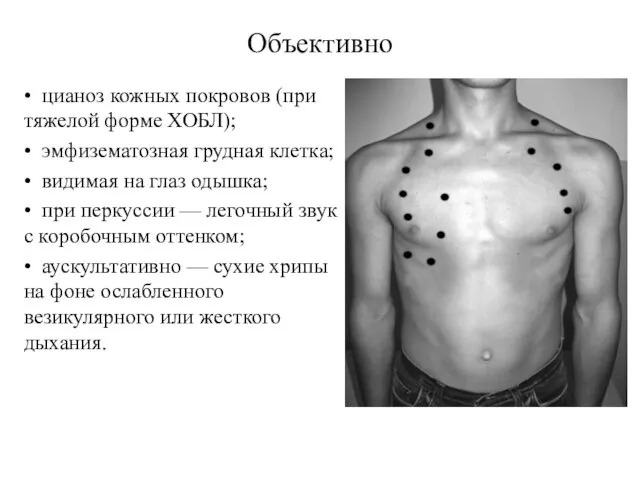 Объективно • цианоз кожных покровов (при тяжелой форме ХОБЛ); • эмфизематозная грудная