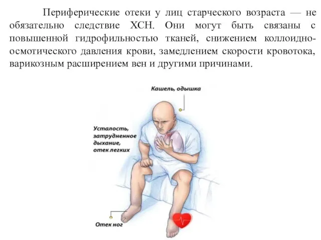 Периферические отеки у лиц старческого возраста — не обязательно следствие ХСН. Они