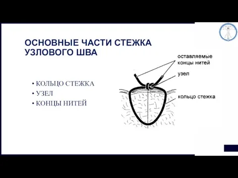 ОСНОВНЫЕ ЧАСТИ СТЕЖКА УЗЛОВОГО ШВА КОЛЬЦО СТЕЖКА УЗЕЛ КОНЦЫ НИТЕЙ