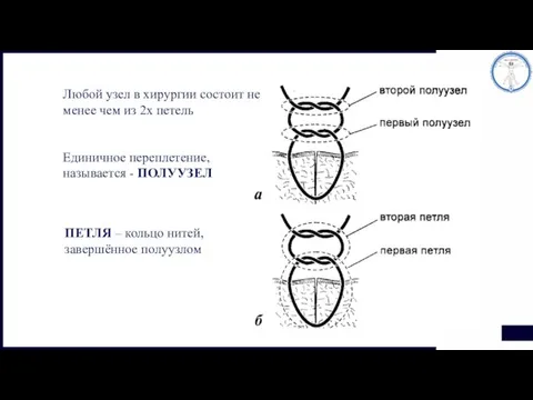 Любой узел в хирургии состоит не менее чем из 2х петель Единичное