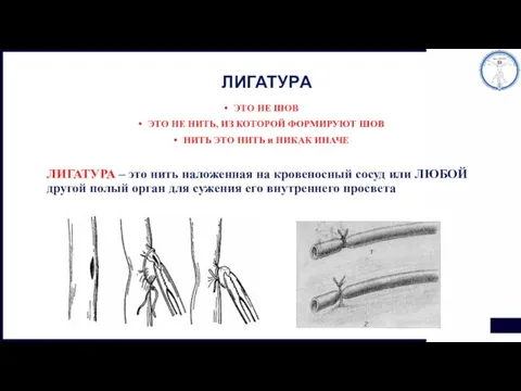 ЛИГАТУРА ЭТО НЕ ШОВ ЭТО НЕ НИТЬ, ИЗ КОТОРОЙ ФОРМИРУЮТ ШОВ НИТЬ