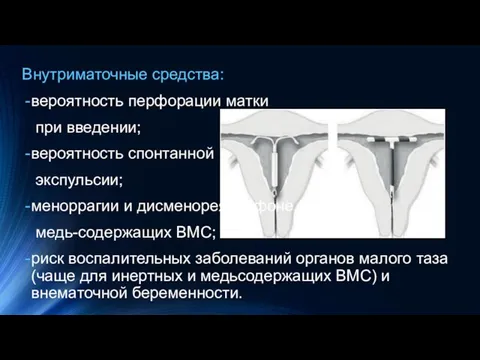 Внутриматочные средства: вероятность перфорации матки при введении; вероятность спонтанной экспульсии; меноррагии и