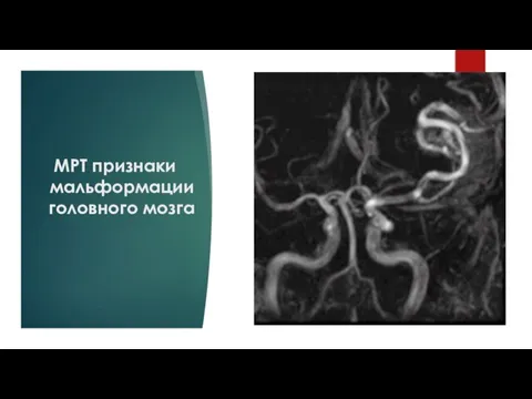 МРТ признаки мальформации головного мозга