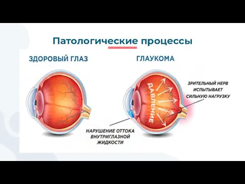 Патологические процессы