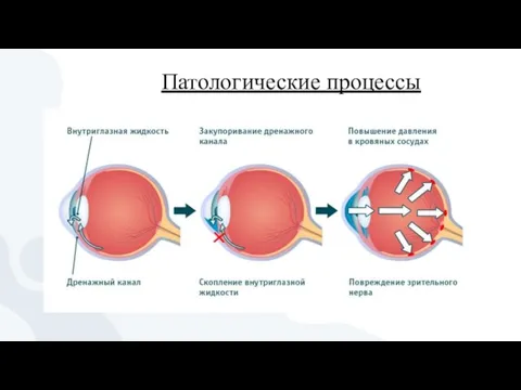 Патологические процессы