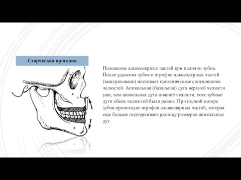 Положение альвеолярных частей при наличии зубов. После удаления зубов и атрофии альвеолярных