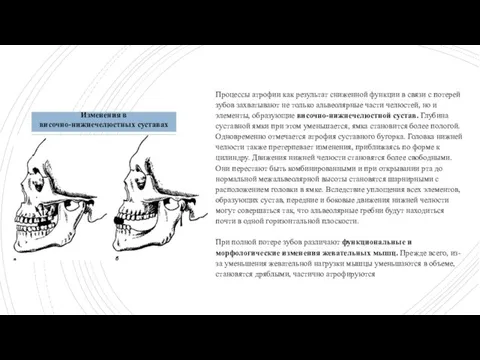 Процессы атрофии как результат сниженной функции в связи с потерей зубов захватывают