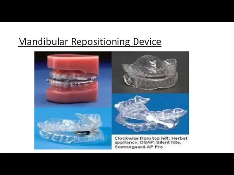 Mandibular Repositioning Device