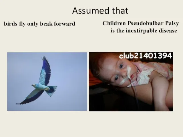 Assumed that birds fly only beak forward Children Pseudobulbar Palsy is the inextirpable disease
