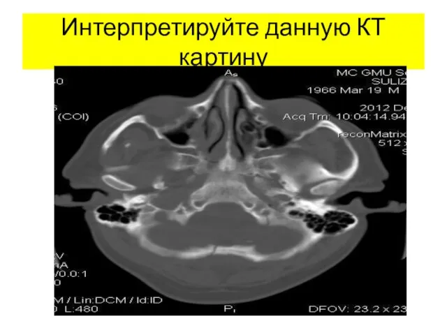 Интерпретируйте данную КТ картину