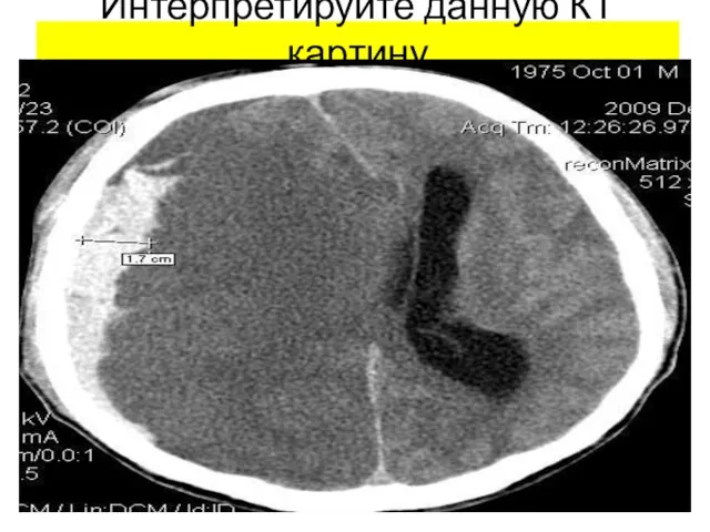 Интерпретируйте данную КТ картину