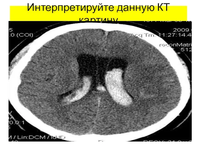 Интерпретируйте данную КТ картину