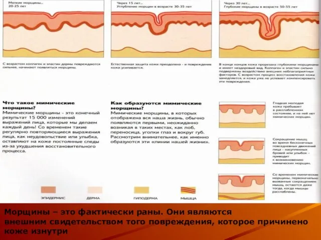 Морщины – это фактически раны. Они являются внешним свидетельством того повреждения, которое