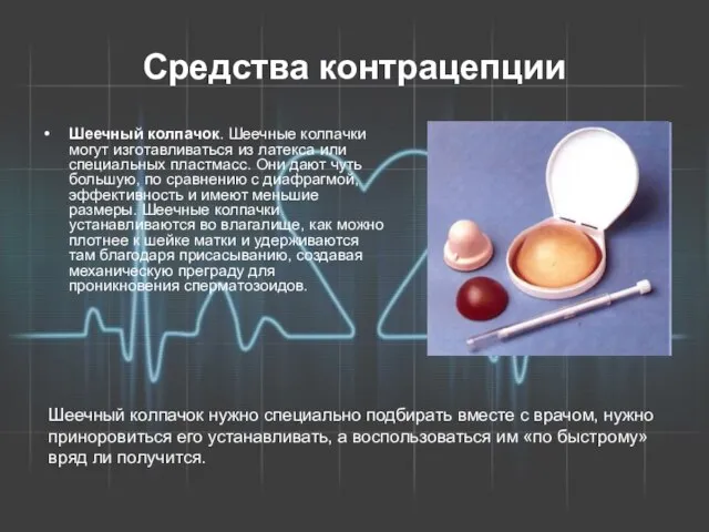 Средства контрацепции Шеечный колпачок. Шеечные колпачки могут изготавливаться из латекса или специальных