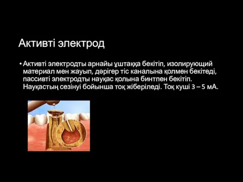 Активті электрод Активті электродты арнайы ұштаққа бекітіп, изолирующий материал мен жауып, дәрігер