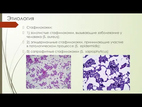 Этиология Стафилококки: 1) золотистые стафилококки, вызывающие заболевание у человека (S. aureus); 2)