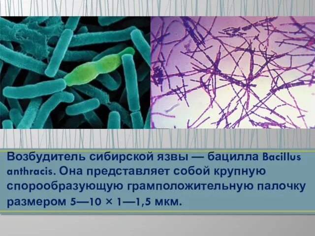 Возбудитель сибирской язвы — бацилла Bacillus anthracis. Она представляет собой крупную спорообразующую