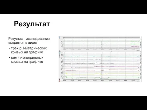 Результат Результат исследования выдается в виде: трех рН-метрических кривых на графике семи импедансных кривых на графике