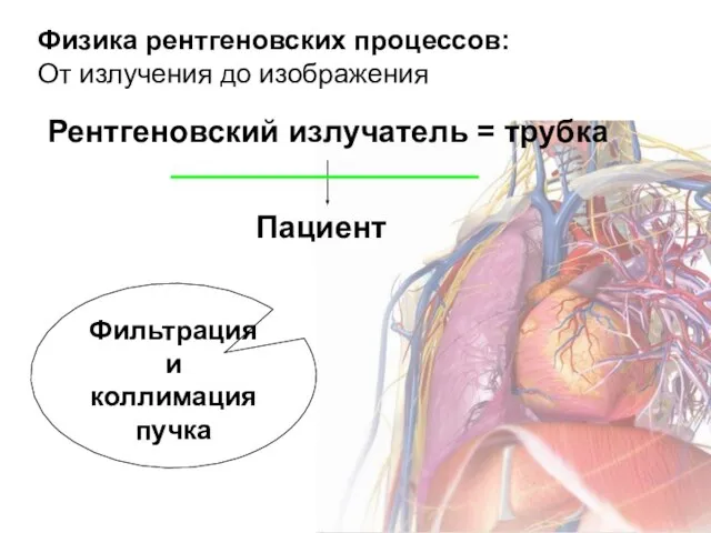 Физика рентгеновских процессов: От излучения до изображения Рентгеновский излучатель = трубка Пациент Фильтрация и коллимация пучка