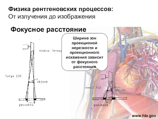 Физика рентгеновских процессов: От излучения до изображения Фокусное расстояние www.fda.gov Ширина зон