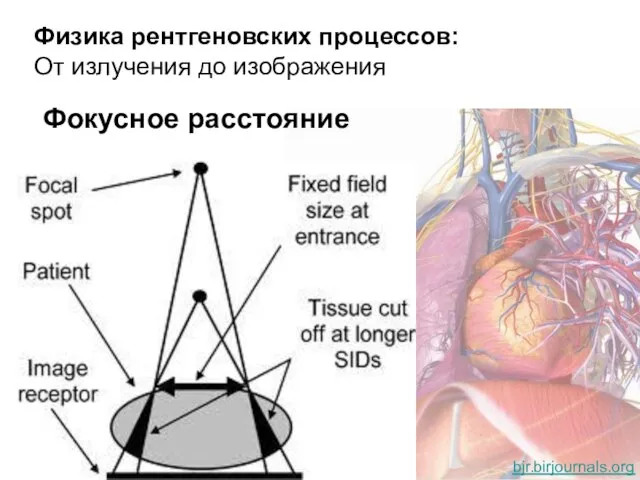 Физика рентгеновских процессов: От излучения до изображения Фокусное расстояние bjr.birjournals.org