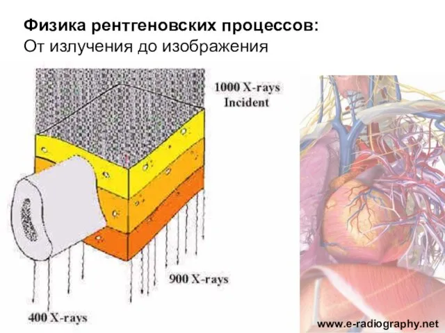 Физика рентгеновских процессов: От излучения до изображения Пациент www.e-radiography.net