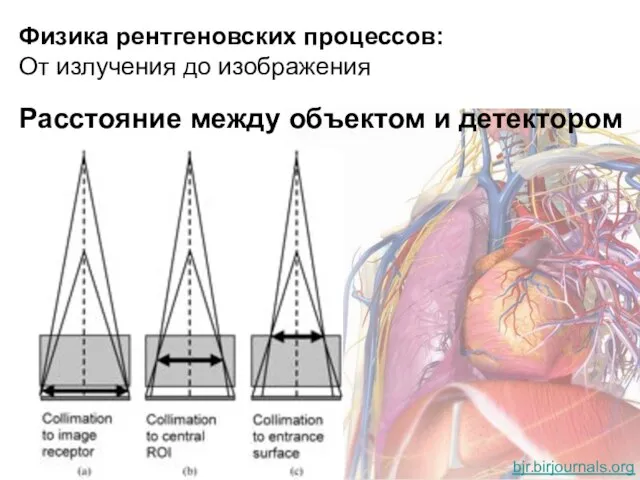 Физика рентгеновских процессов: От излучения до изображения Расстояние между объектом и детектором bjr.birjournals.org