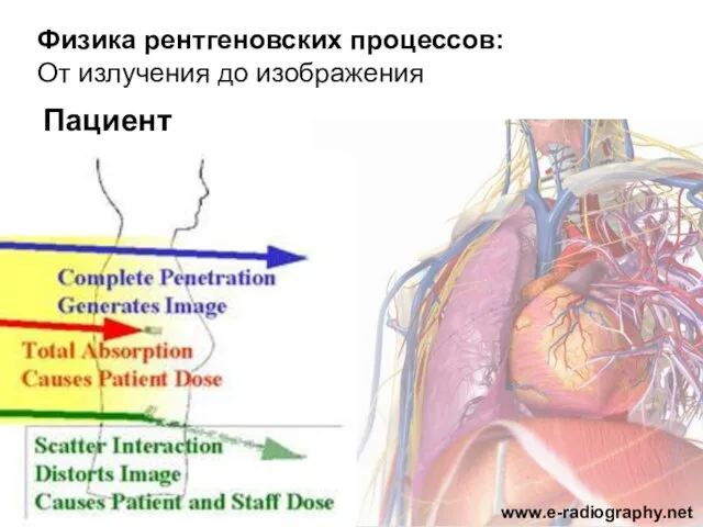 Физика рентгеновских процессов: От излучения до изображения Пациент www.e-radiography.net