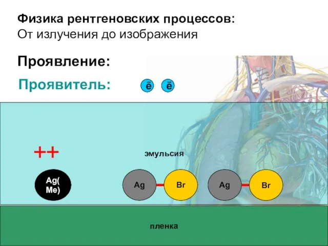 Физика рентгеновских процессов: От излучения до изображения Проявление: пленка эмульсия Ag Ag