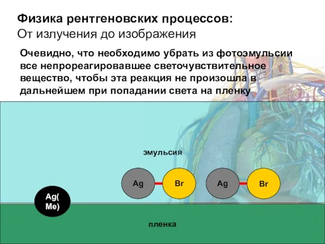 Физика рентгеновских процессов: От излучения до изображения пленка эмульсия Ag Br Ag