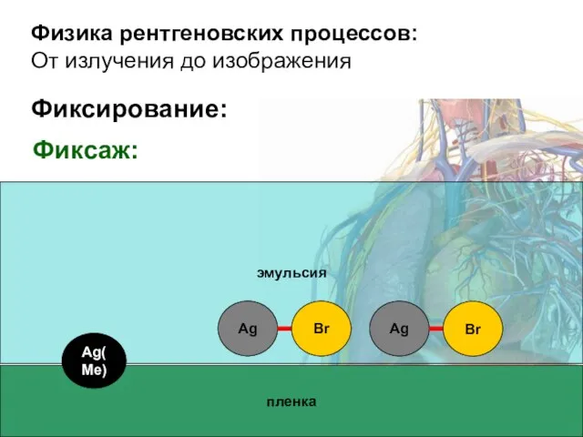 Физика рентгеновских процессов: От излучения до изображения пленка эмульсия Ag Br Ag Br Ag(Me) Фиксирование: Фиксаж: