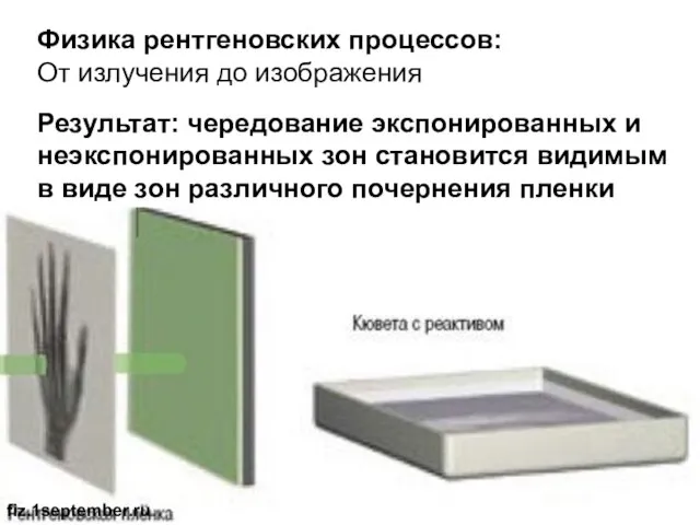 Физика рентгеновских процессов: От излучения до изображения fiz.1september.ru Результат: чередование экспонированных и