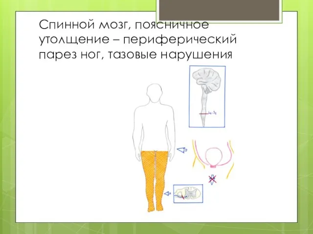 Спинной мозг, поясничное утолщение – периферический парез ног, тазовые нарушения