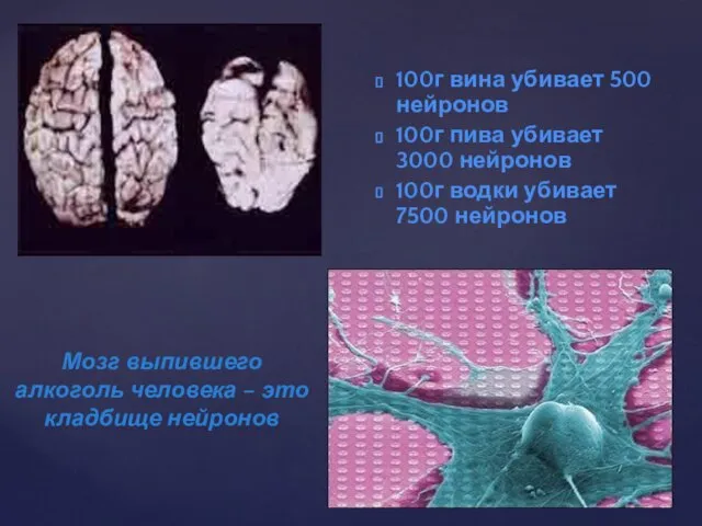 100г вина убивает 500 нейронов 100г пива убивает 3000 нейронов 100г водки