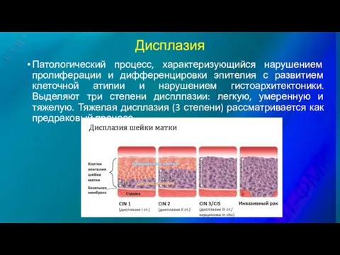 Дисплазия Патологический процесс, характеризующийся нарушением пролиферации и дифференцировки эпителия с развитием клеточной