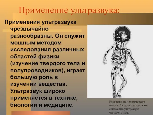 Применение ультразвука: Применения ультразвука чрезвычайно разнообразны. Он служит мощным методом исследования различных