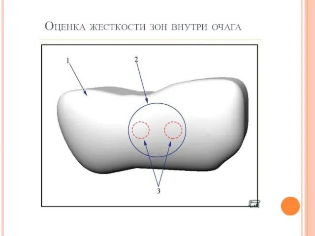 Оценка жесткости зон внутри очага