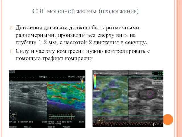 СЭГ молочной железы (продолжение) Движения датчиком должны быть ритмичными, равномерными, производиться сверху