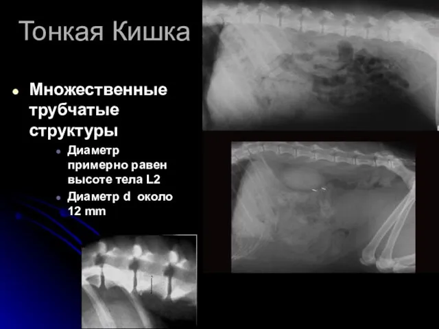 Тонкая Кишка Множественные трубчатые структуры Диаметр примерно равен высоте тела L2 Диаметр d около 12 mm