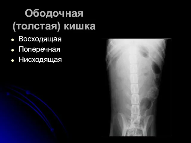 Ободочная (толстая) кишка Восходящая Поперечная Нисходящая