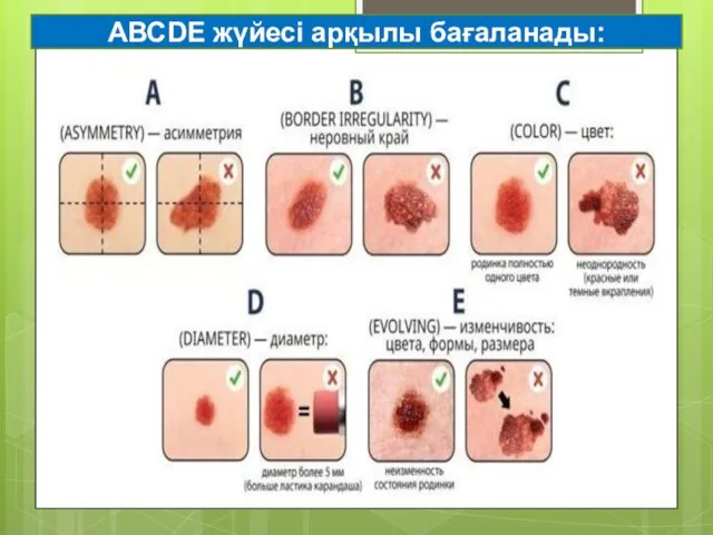 АВСDE жүйесі арқылы бағаланады: