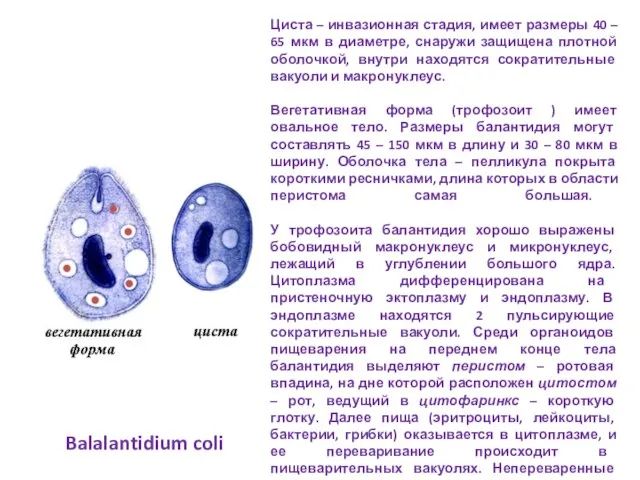 Циста – инвазионная стадия, имеет размеры 40 – 65 мкм в диаметре,