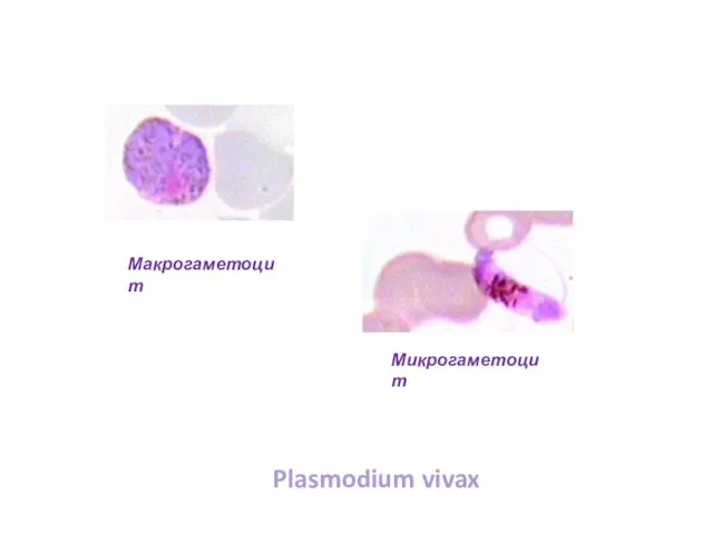 Макрогаметоцит Микрогаметоцит Plasmodium vivax