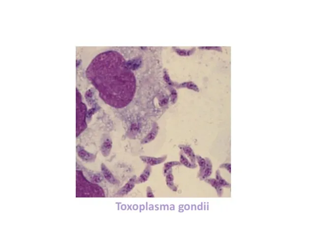 Toxoplasma gondii