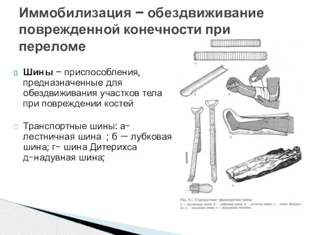 Шины – приспособления, предназначенные для обездвиживания участков тела при повреждении костей Транспортные